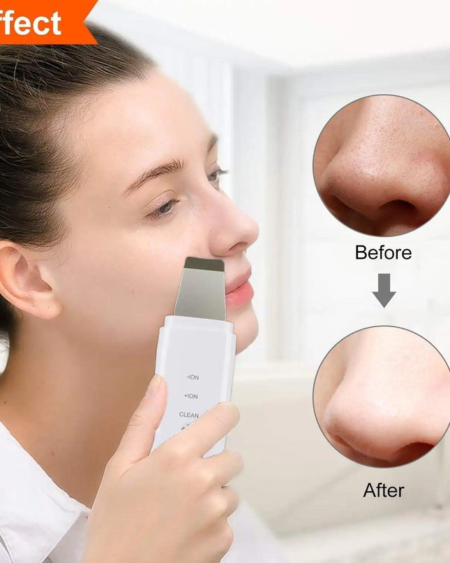 Ultrasonic Skin Scrubber