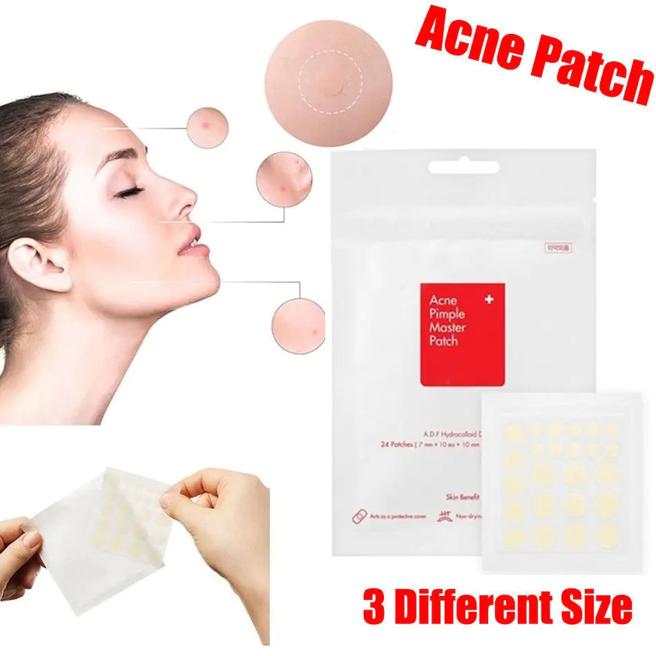 Face Acne Pimple Spot Scar Care Treatment Stickers