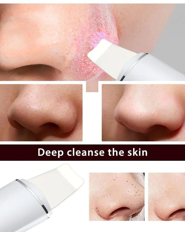 Ultrasonic Skin Scrubber Blackhead Remover