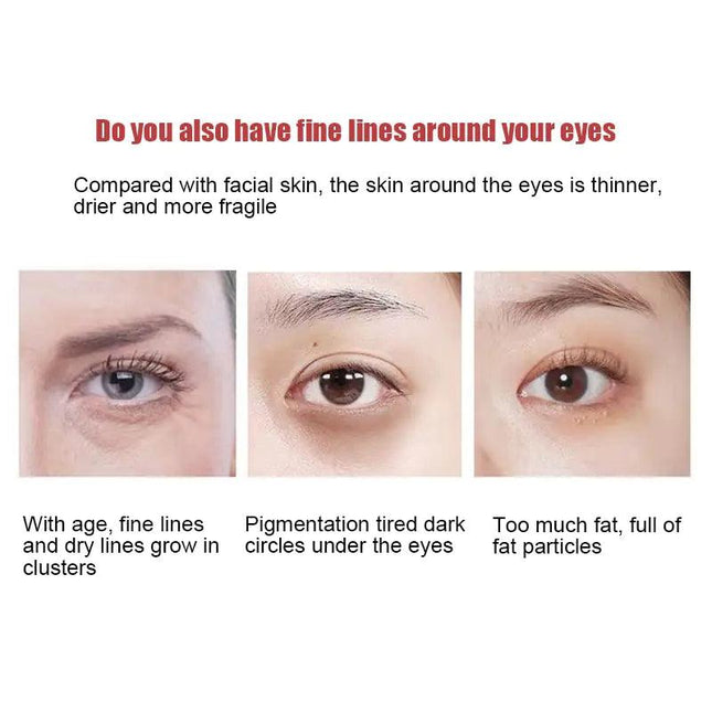 New Anti-Wrinkle Eye Cream