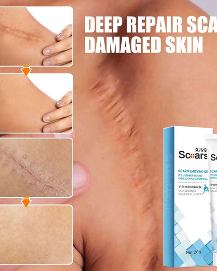 New Herbal Scar Repair Cream