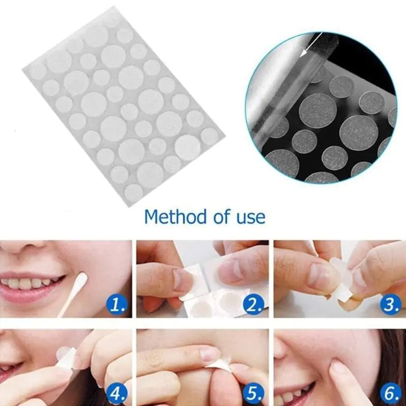 Face Acne Pimple Spot Scar Care Treatment Stickers