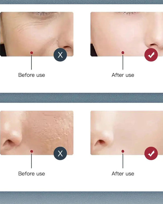 LED Facial Therapy Mask