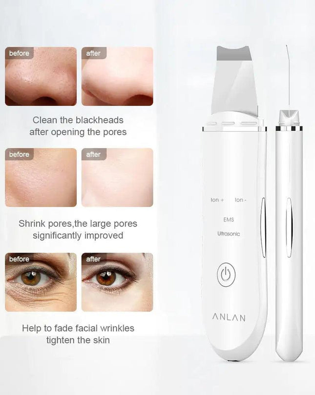 Ultrasonic Skin Scrubber