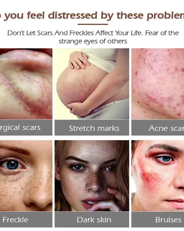 New Herbal Scar Repair Cream