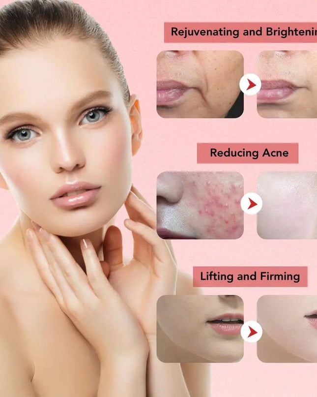 Face Lift Skin Rejuvenation Facial Massager