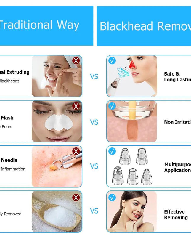 Electric Blackhead Remover Vacuum Cleaner