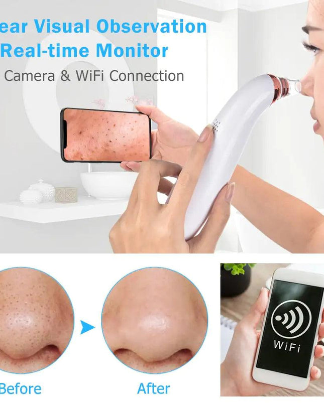 Electric Blackhead Remover Vacuum Cleaner