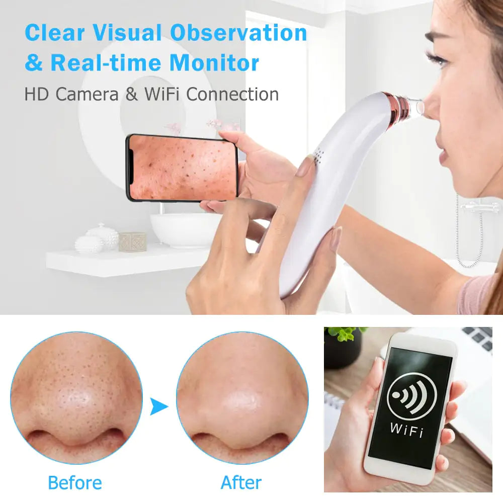 Electric Blackhead Remover Vacuum Cleaner