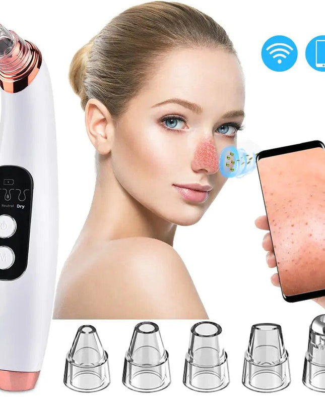 Electric Blackhead Remover Vacuum Cleaner