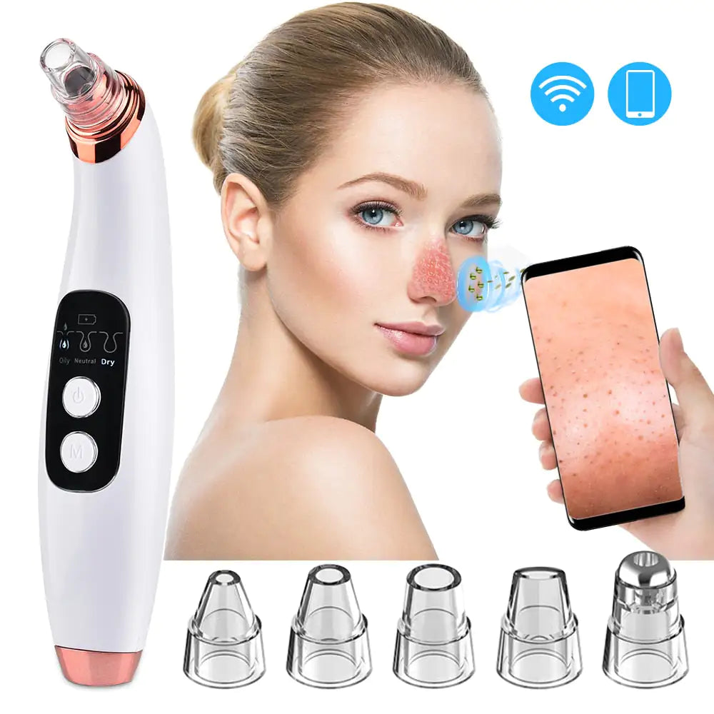 Electric Blackhead Remover Vacuum Cleaner