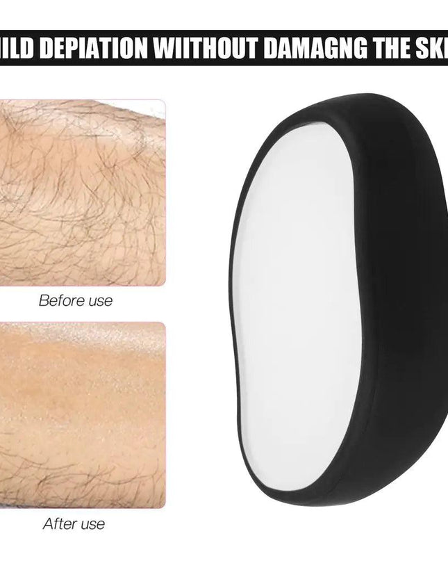 Crystal Eraser Physical Hair Removal