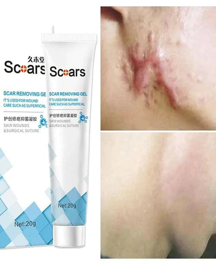 New Herbal Scar Repair Cream