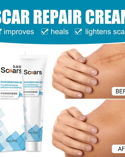 New Herbal Scar Repair Cream