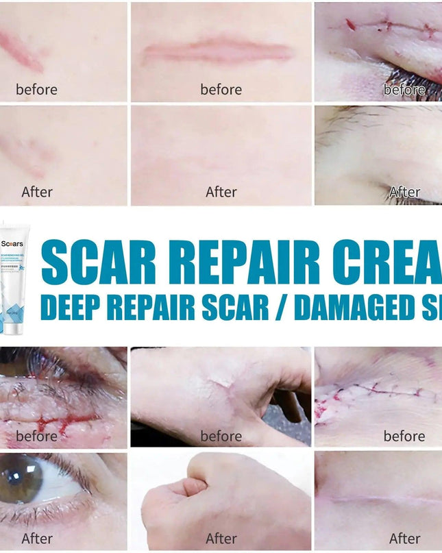 New Herbal Scar Repair Cream